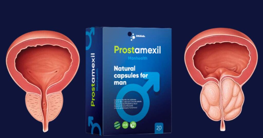 Prostamexil 1